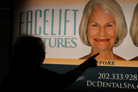 Facelift dentures